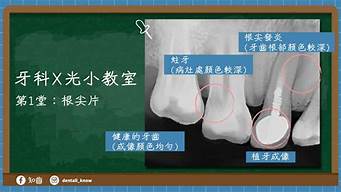 牙科X光片能发现哪些口腔问题？(牙科x光片多少钱一次)